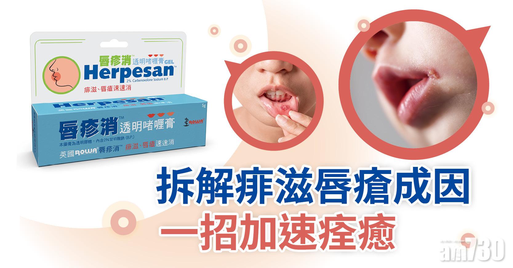 拆解痱滋唇瘡成因 一招加速痊癒