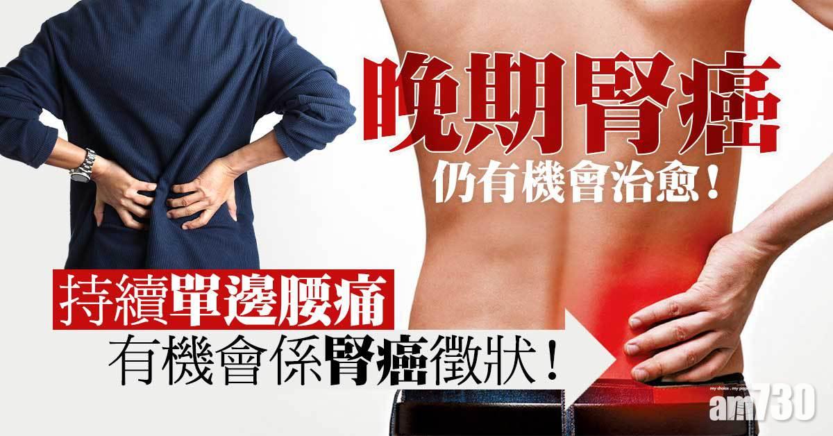 晚期腎癌 治愈仍有機會