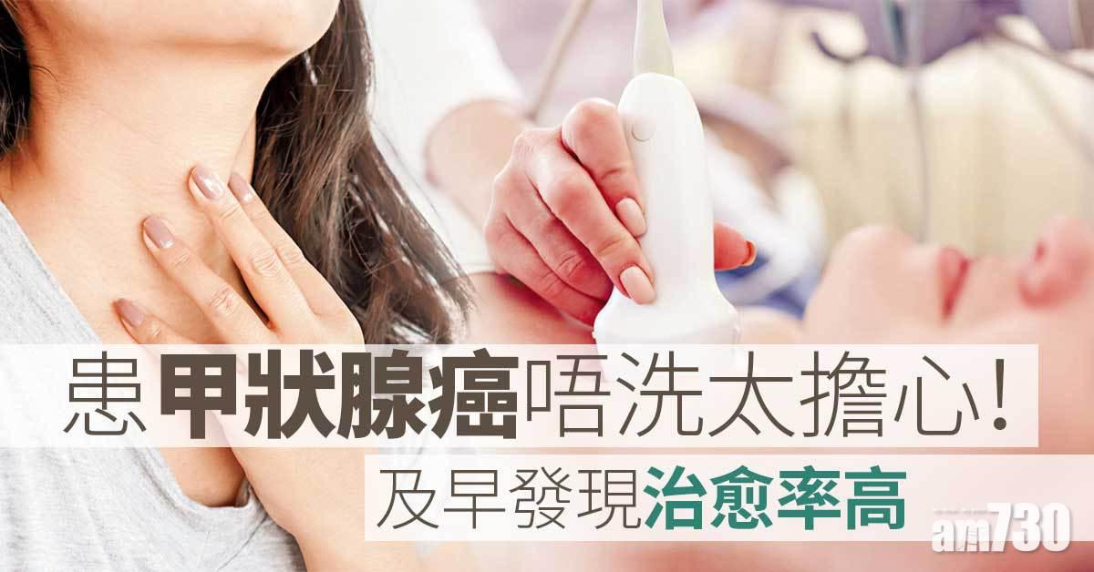 甲狀腺癌治愈率高 勿過分憂慮