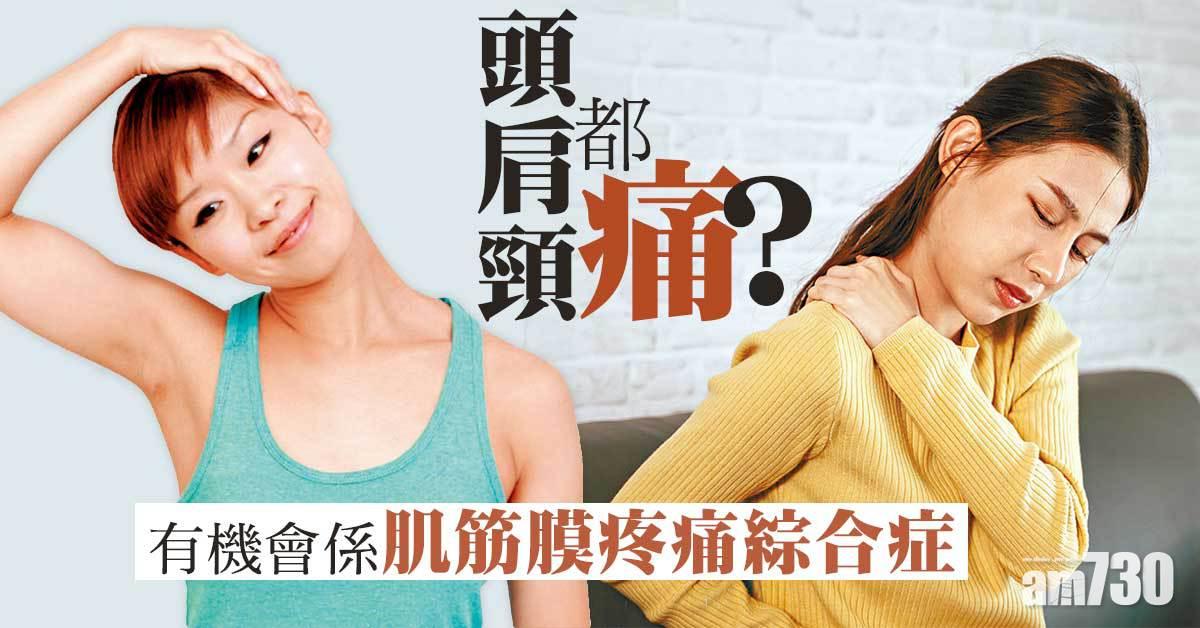 頭肩頸環環扣 肌筋膜疼痛綜合症