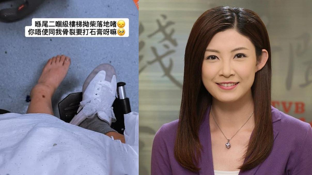張文采跌斷腳　骨裂打石膏需坐輪椅　曾戀「負評王」羅鈞滿自嘲太蠢