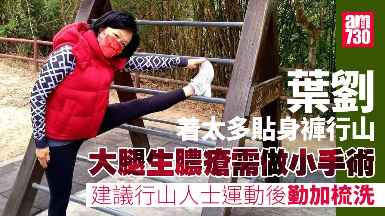 Ray Online｜葉劉着太多貼身褲行山大腿生膿瘡　教路做運動後點樣避免發炎