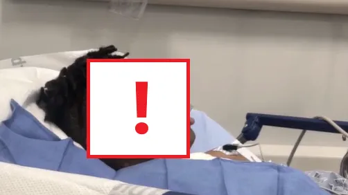 12歲童睡覺遭3友整蠱滾水潑臉 現巨型水泡 面目全非(慎入)