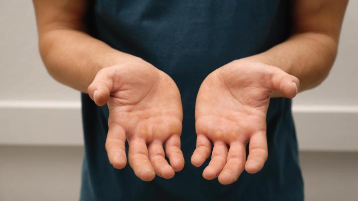 參加HYROX比賽!手會長繭?